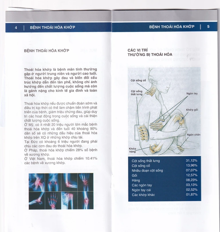 Dung dịch Duo Vital 500ml Gramme Revit giảm đau nhức khớp, thoái hoá khớp