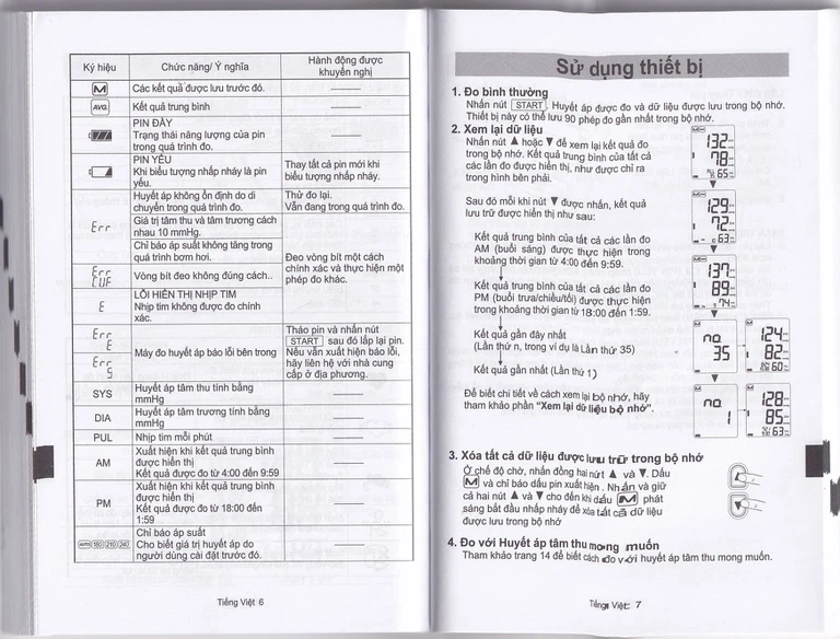 Máy đo huyết áp bắp tay tự động AND UA-1020 hỗ trợ đo huyết áp, cảnh báo đột quỵ